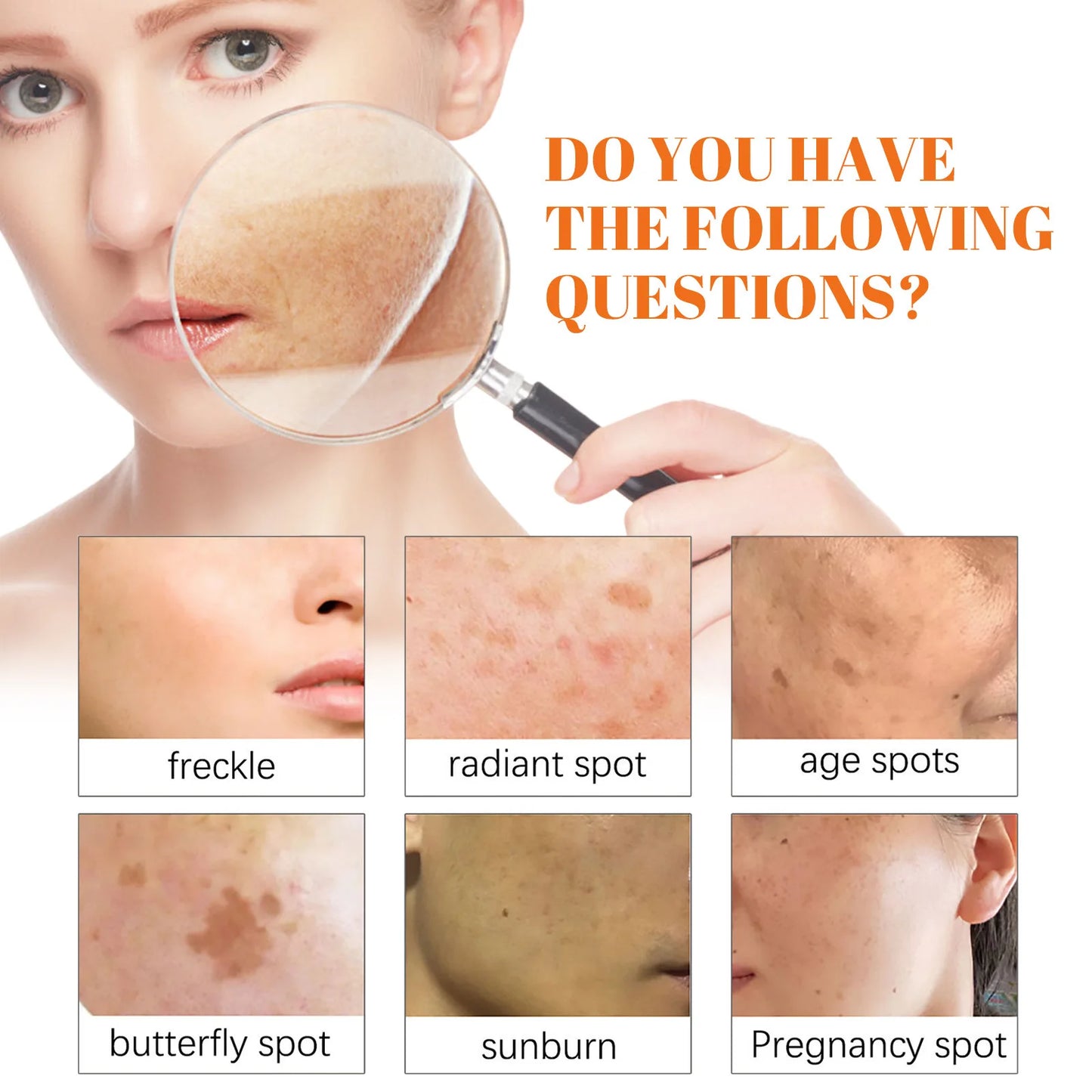 Freckle Whitening Face Cream Papaya Day Night Sun Spots Corrector