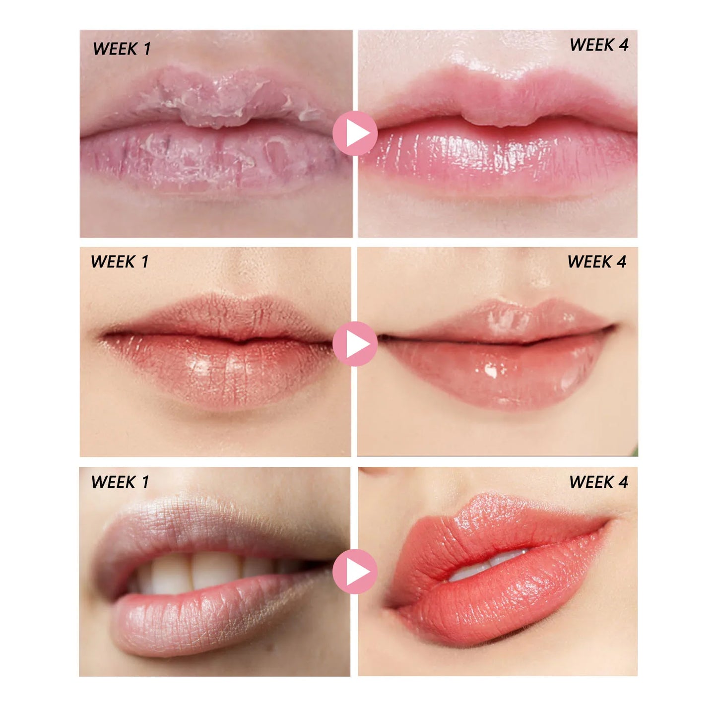 Pink Lips Scrub Exfoliator Dead Skin Removal