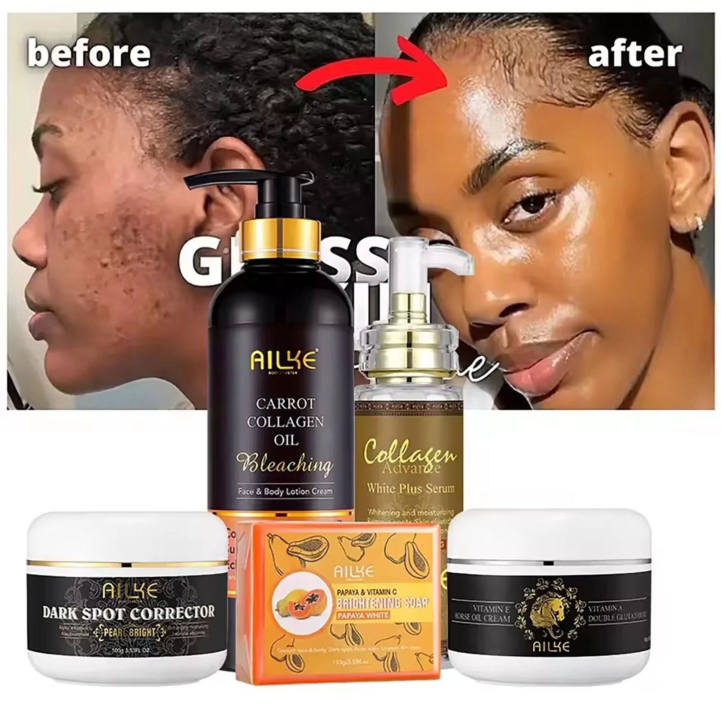 AILKE Collagen 5-in-1 Skin Care Set, Restore Skin Elasticity,