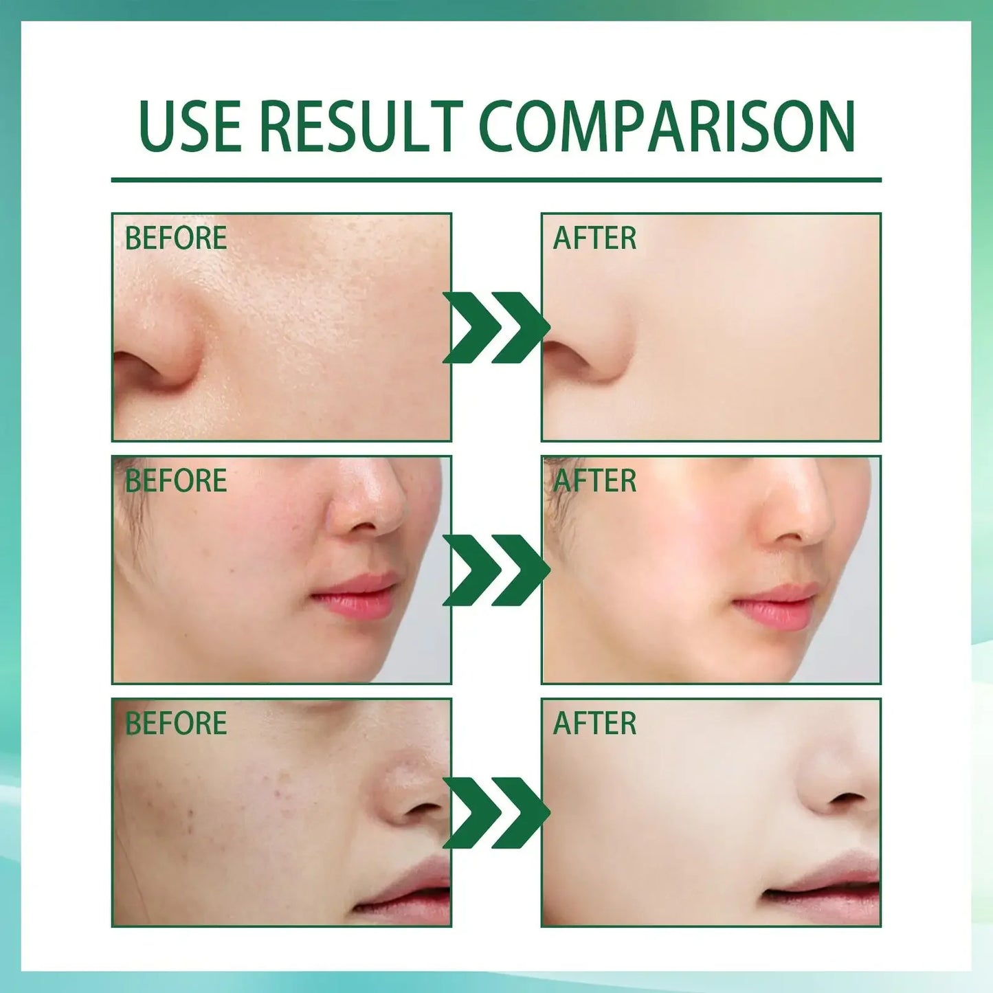 30ML Vitamin B5 Essence Liquid Facial Firming Serum