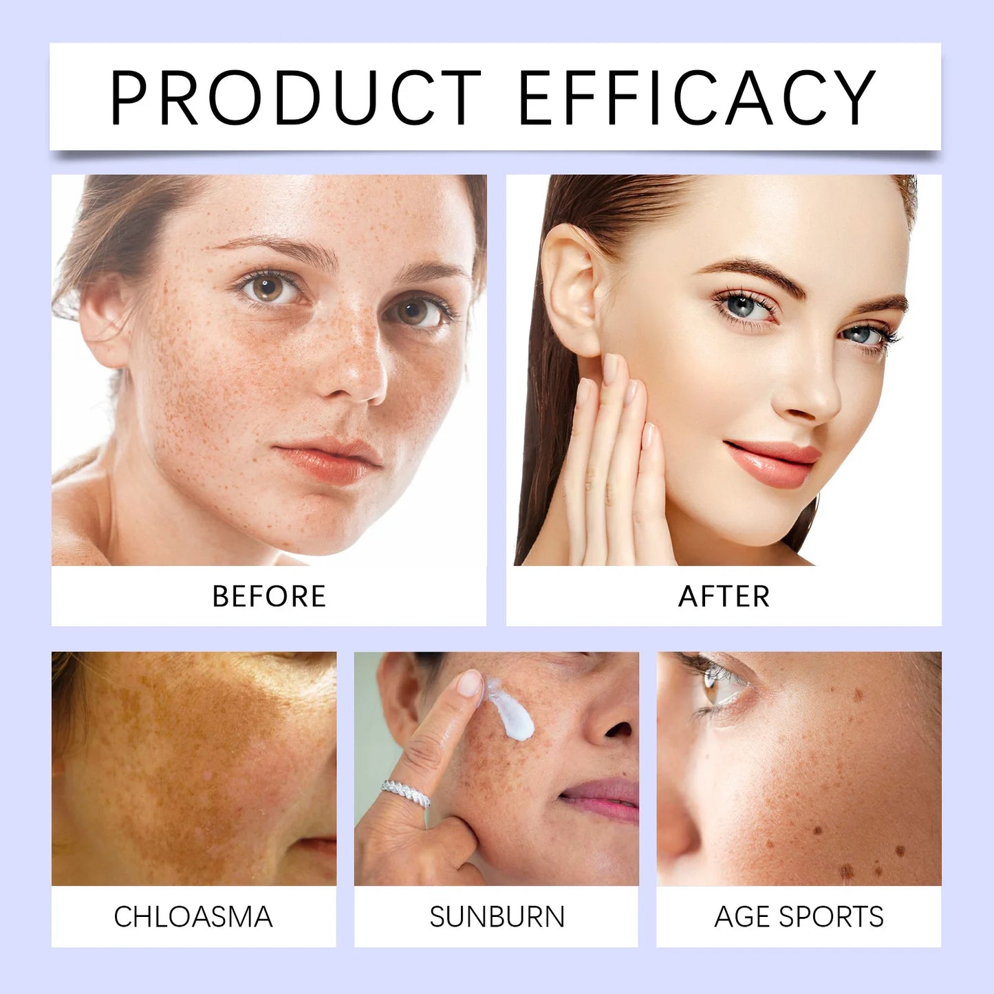Ouhoe Facial Spot Remover Nourishes, Moisturizes, Lightens, and Firms Skin