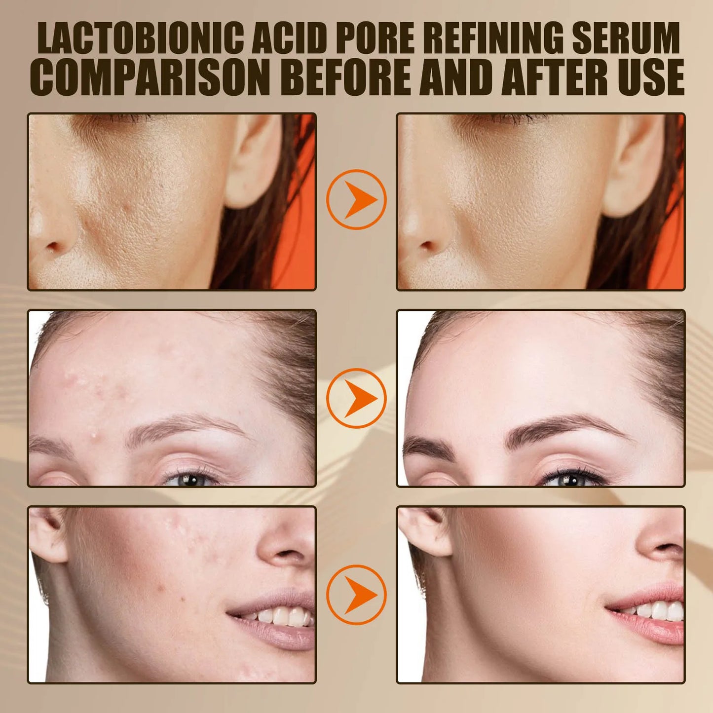 Lactose Acid Pore Narrowing Essence Hydrating Moisturizing Delicate Repair
