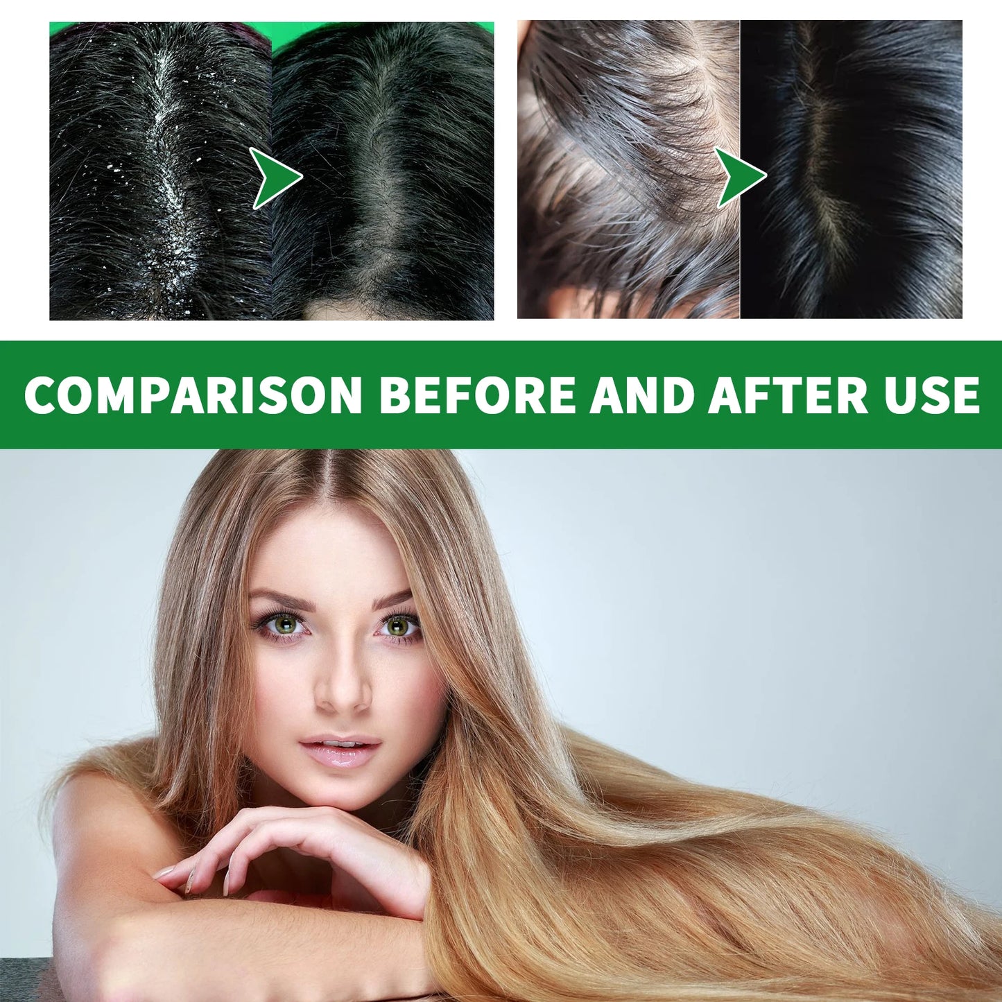 Anti Dandruff Shampoo