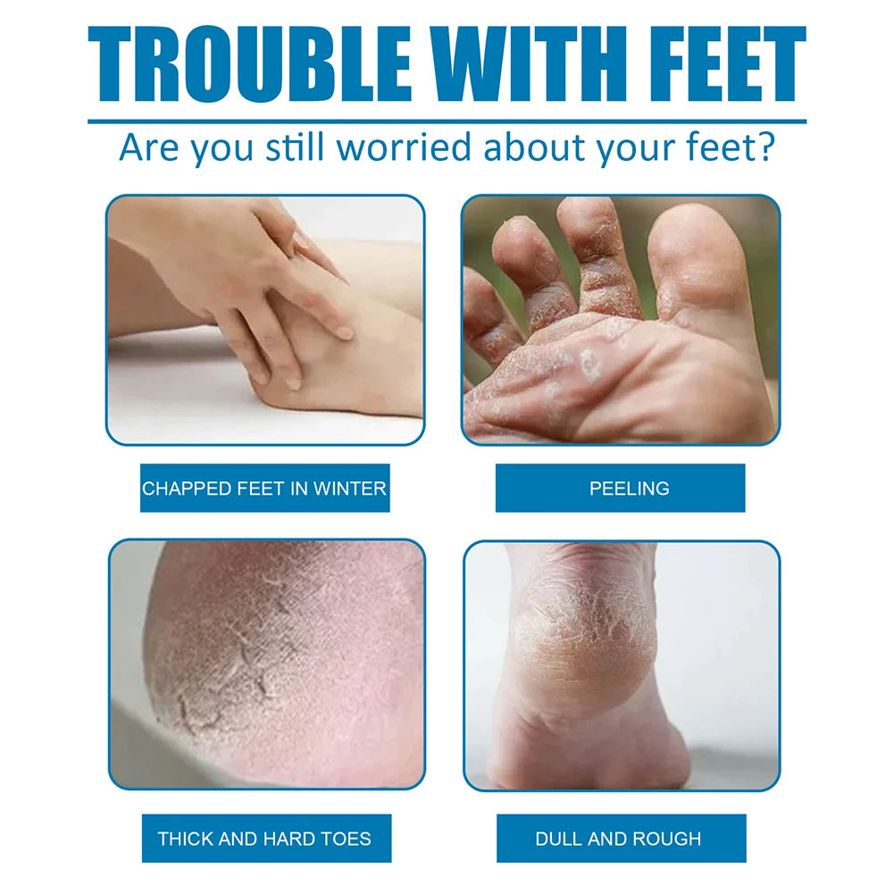 1 Pair Exfoliating Moisture Feet Mask