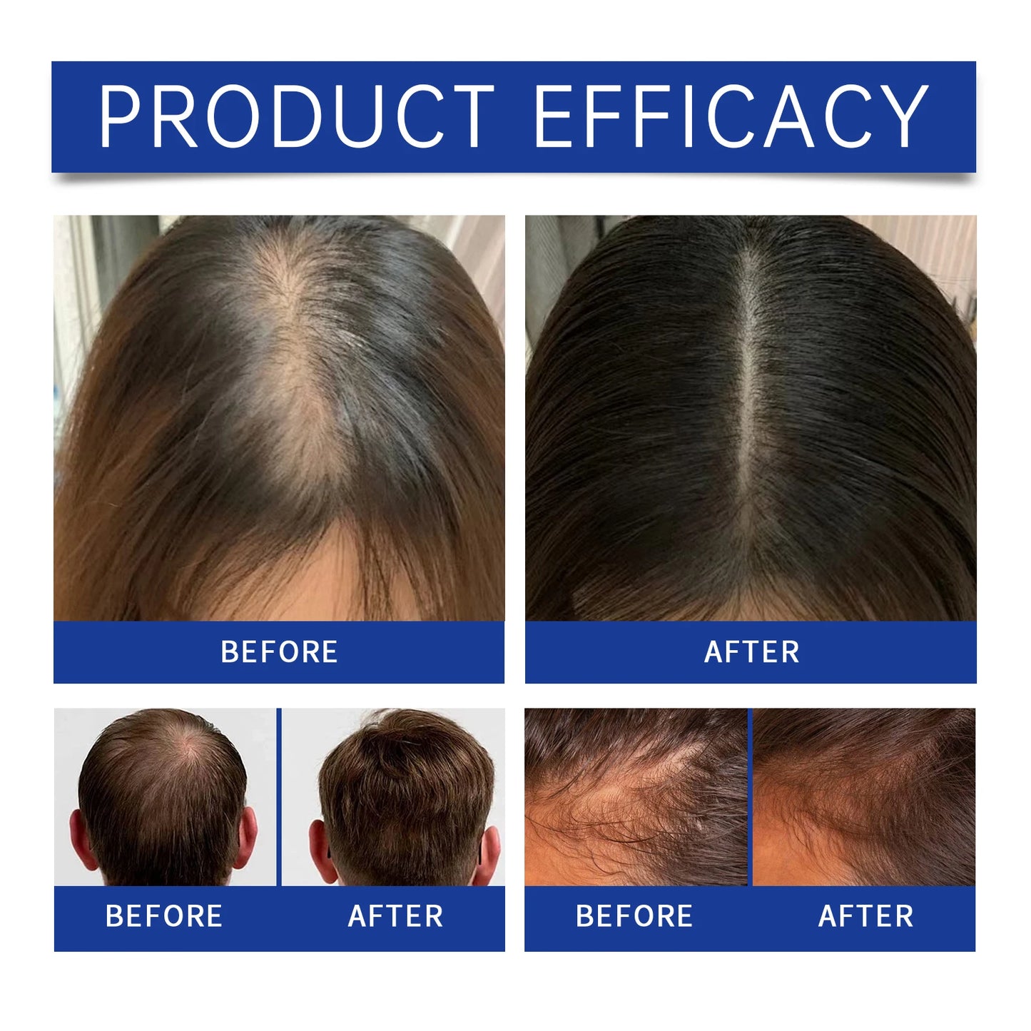 EELHOE Blue Copper Peptide Shampoo ,