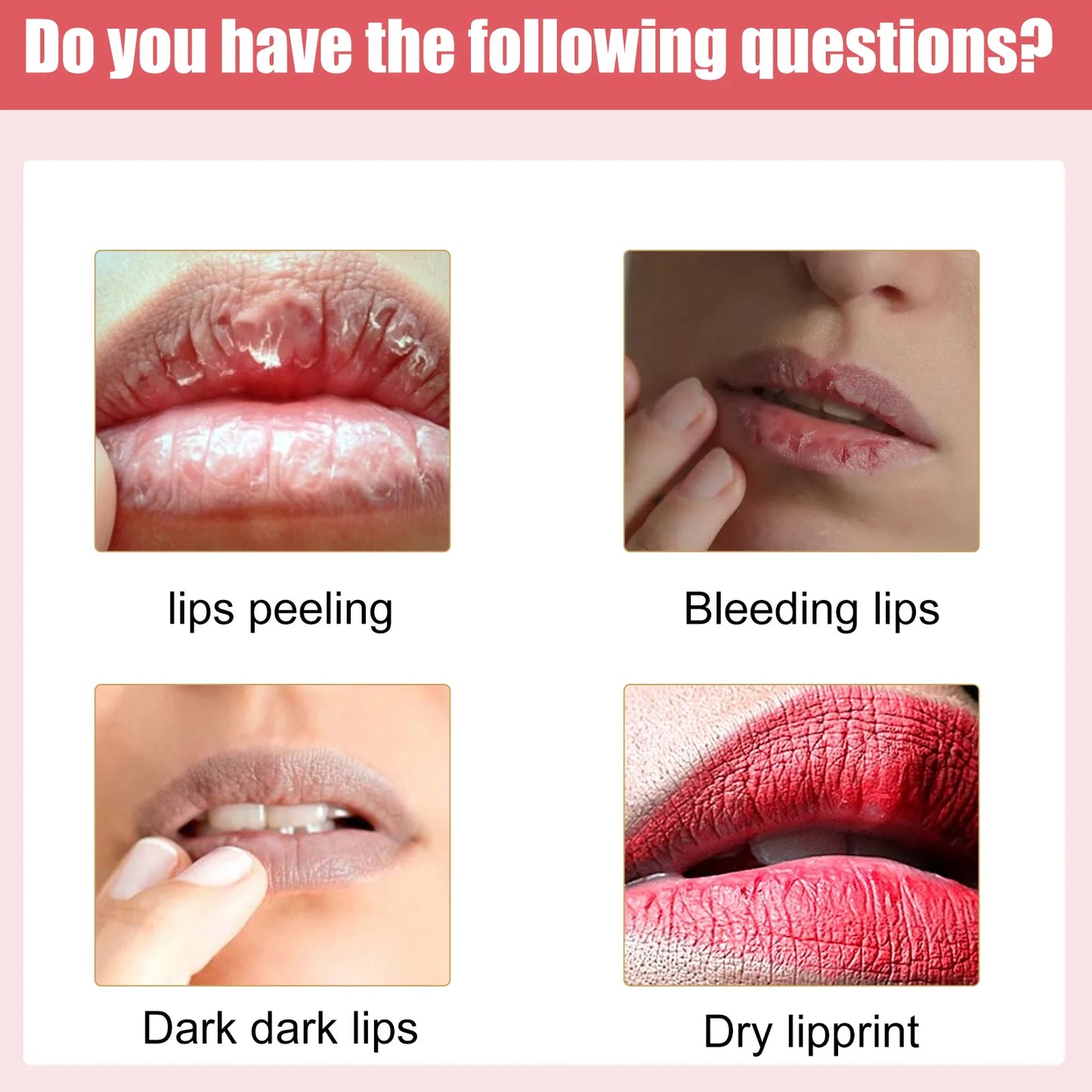 5pcs/set Lip Lightening Cream Moisturizing Lip Balm